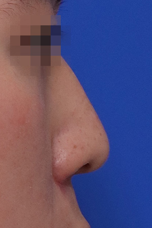 Before surgery