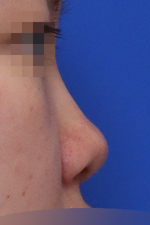 Before surgery