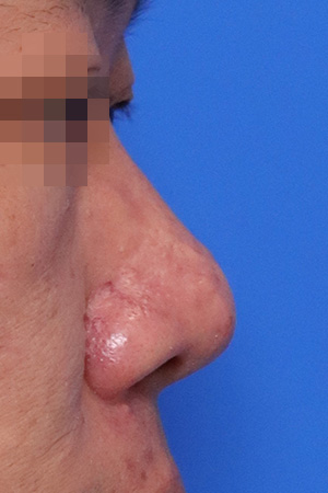 Before surgery