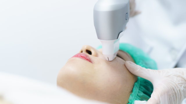 Practitioner applying a skin-tightening device to a patient's cheek