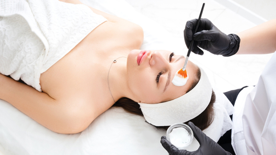 Chemical Peels