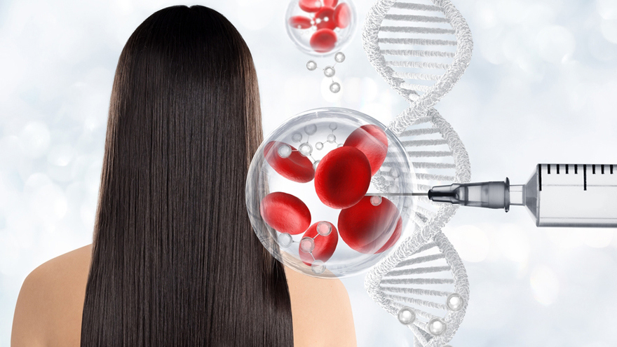 Stem Cell Therapy in Dermatology – IV Full-Body Treatments, Facial Rejuvenation & Hair Restoration
