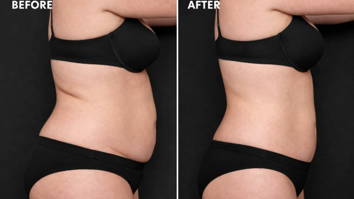 Localized Body Contour Improvement before and after