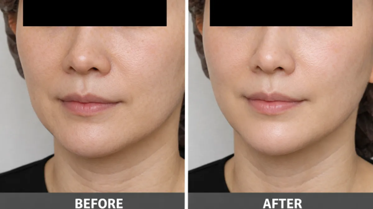 Skin Firmness Improvement before and after