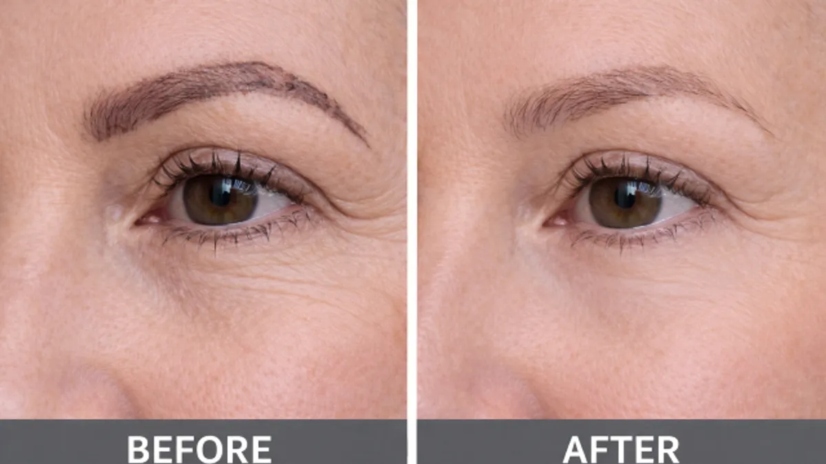 Cosmetic Tattoo Correction before and after