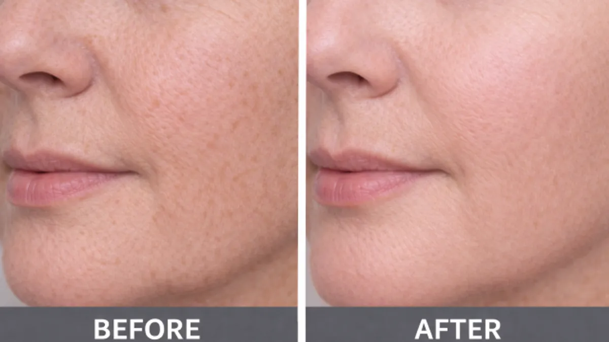 Skin Glow Maintenance before and after