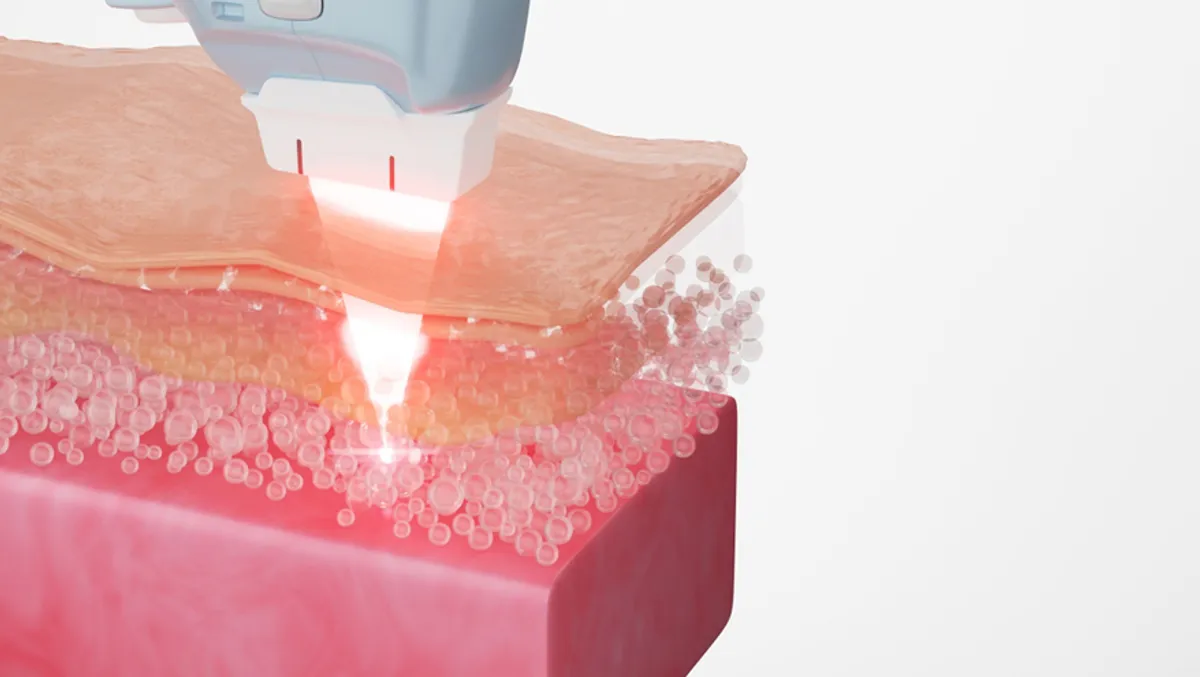 stimulate collagen