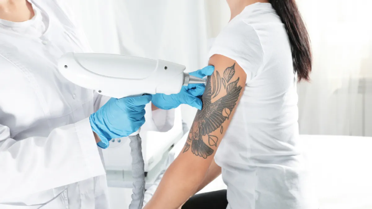 Key Benefits of Laser Tattoo Removal