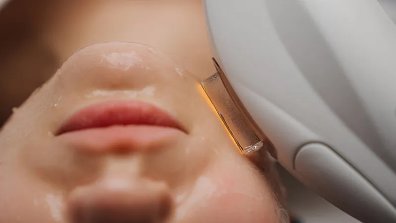 Practitioner using a handheld device on a woman’s cheek.