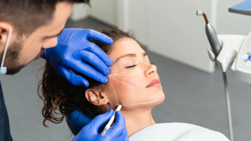 Facial vector mapping: practitioner drawing lift lines from the temple across the cheek and jawline before injectable treatment