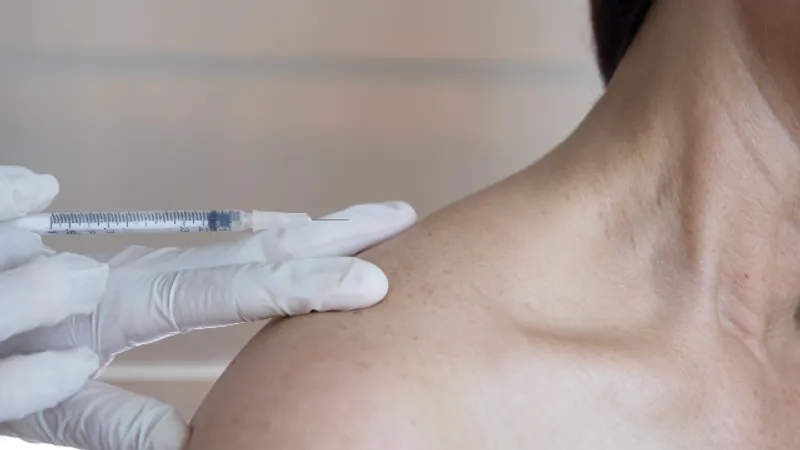 Patient receiving shoulder filler injections for shoulder contouring.