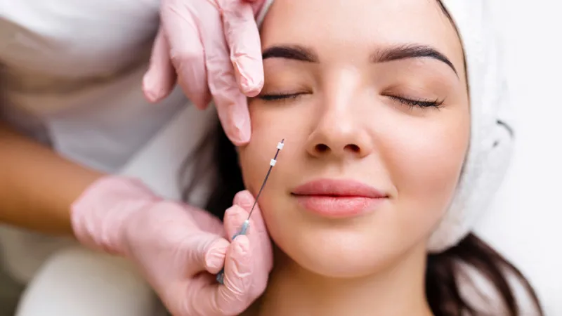 Doctor performing facial tissue lifting with PDO threads