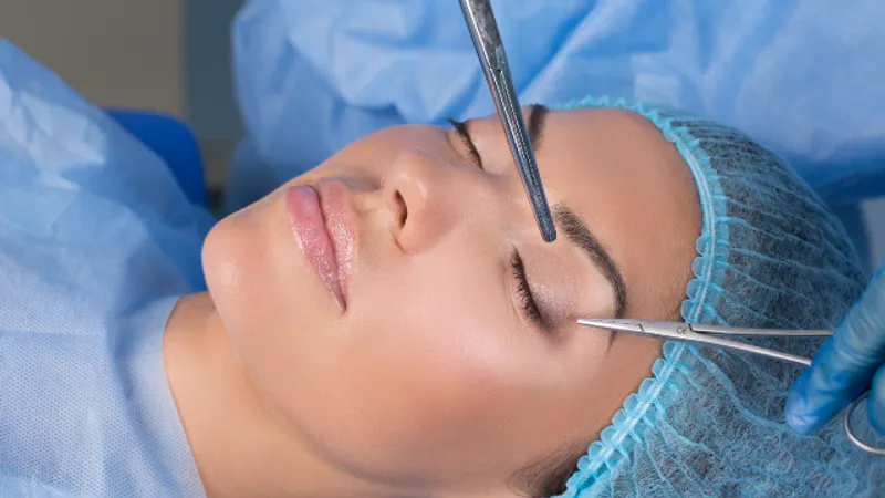 Patient undergoing endoscopic brow lift surgery with surgical instruments positioned around the forehead and eyebrow area.