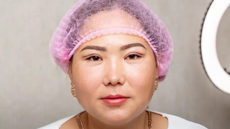 Pre-operative evaluation of inner eye corner epicanthal folds for epicanthoplasty surgery