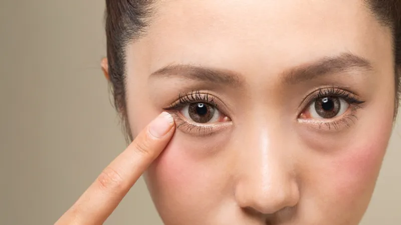 Dual canthoplasty eye corner treatment evaluation