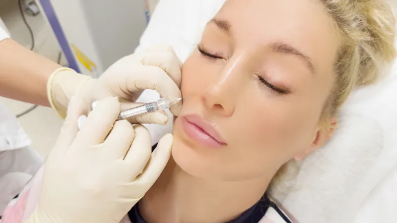 Patient receiving dermal filler injections on the face.