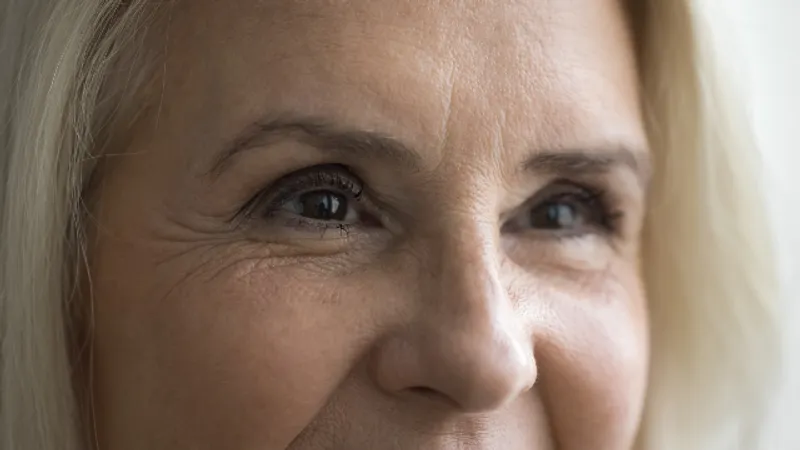 Person with visible signs of aging around the eyes, including under-eye and eyelid changes.
