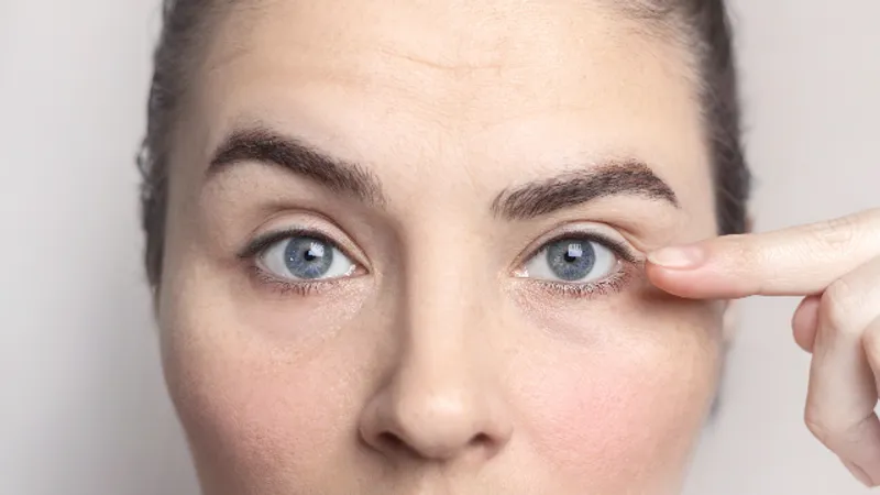 Woman pointing to the outer eye area to illustrate brow position and upper-eyelid heaviness.