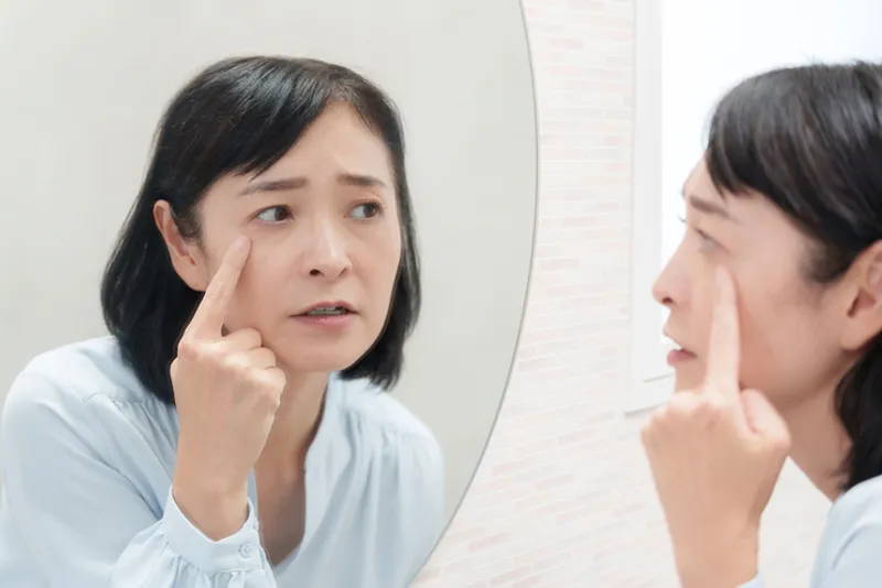 A concerned middle-aged Asian woman looking in the mirror and checking sagging skin around her eyes, evaluating candidacy for middle-age eyelid surgery.
