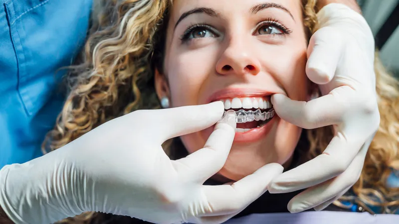 Invisalign Treatment