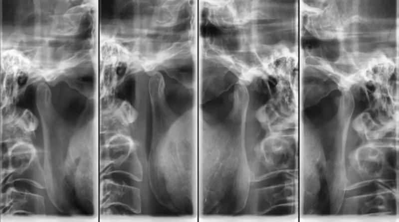 Radiographic Imaging