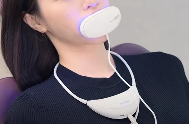 プロフェッショナル歯のホワイトニング