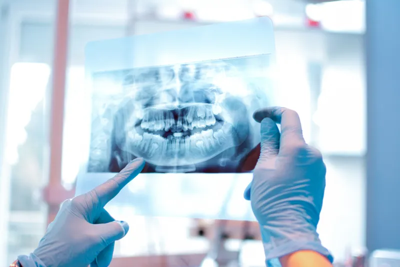 Radiographic Imaging