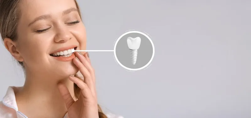 Osstem Implant