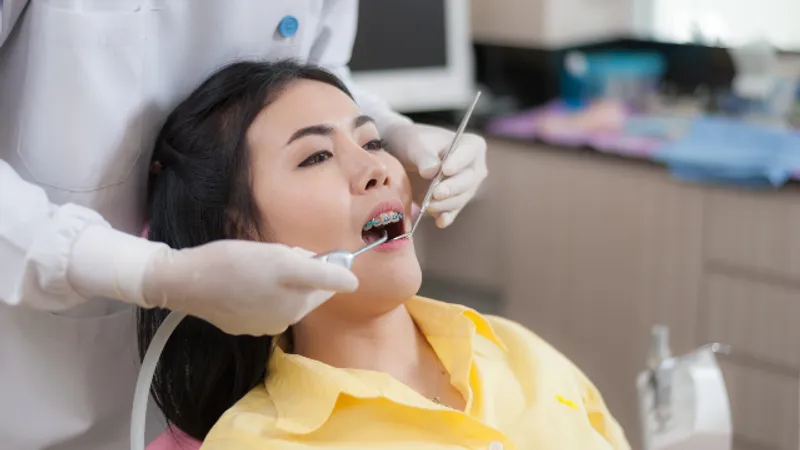 The Procedure