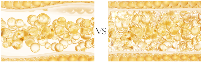 Medical illustration comparing loosely spaced and densely packed tissue structures.