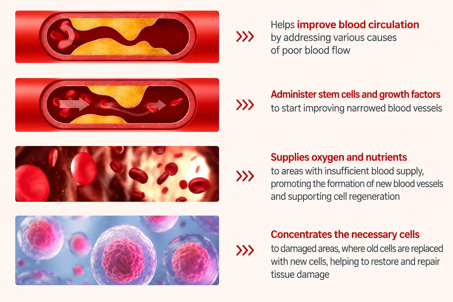 Illustration of a narrowed or blocked blood vessel showing poor blood circulation
