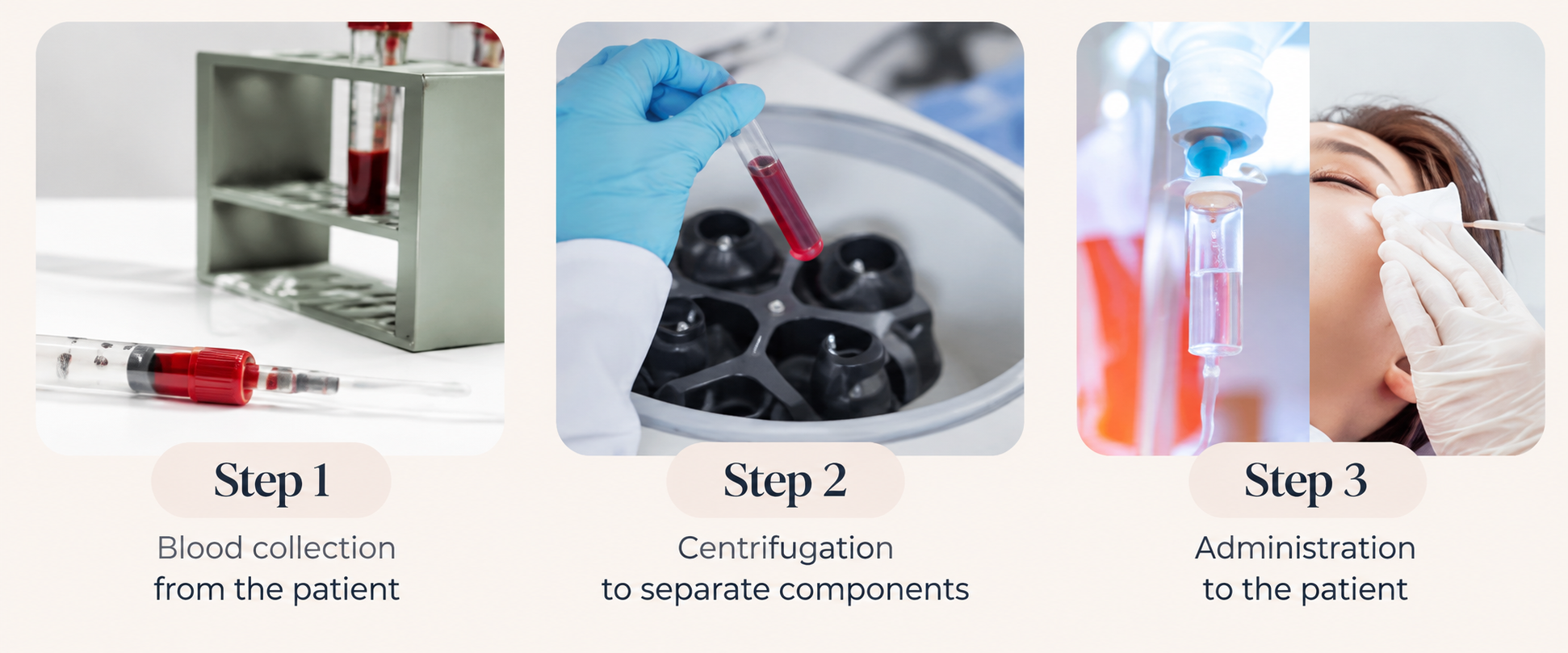 Three-step PRP procedure timeline: blood collection, centrifugation, and administration to patient