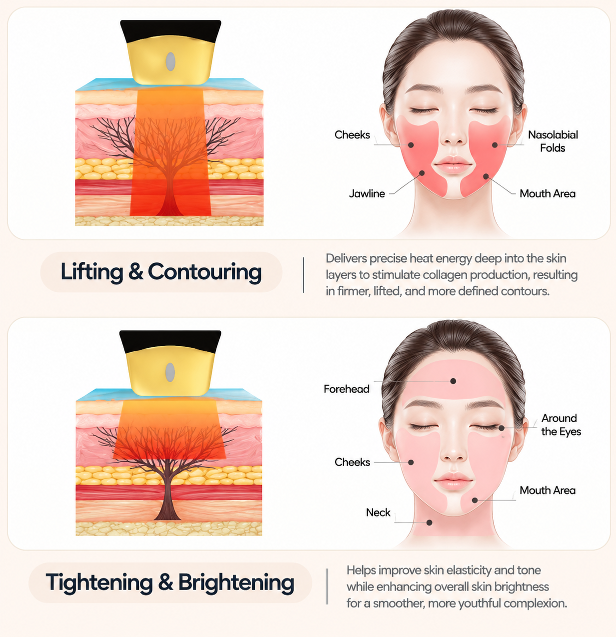 Medical illustration showing lifting, contouring, tightening, and brightening treatment areas.