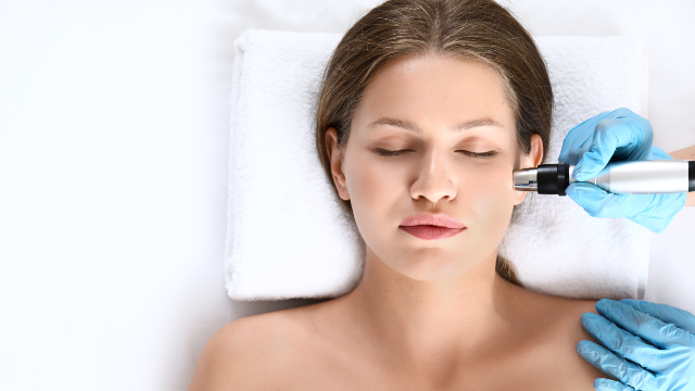 Patient receiving Thermage FLX radiofrequency treatment on the face.