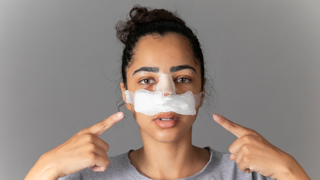 Woman pointing to a post-surgical nasal splint and dressing covering her nose during rhinoplasty recovery