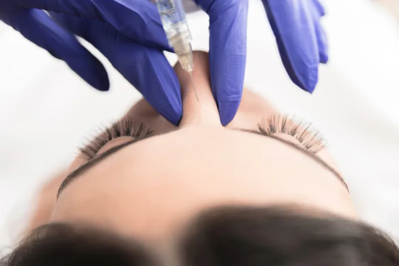 Practitioner injecting the bridge of a woman’s nose with a syringe.
