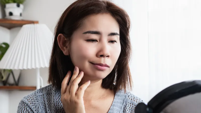 Woman experiencing facial palsy with visible facial weakness and asymmetry.